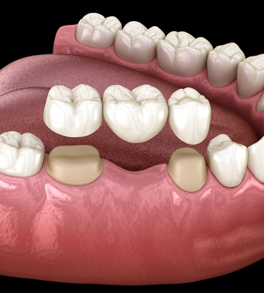 Treatment - Six Gables : Dental Practice