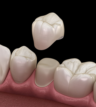 Treatment - Six Gables : Dental Practice